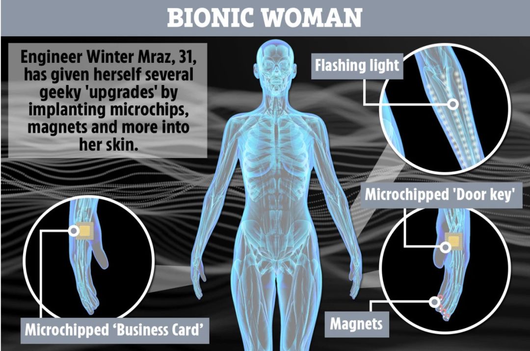 女子车祸后开始“改造”自己：左手芯片开门、右手可刷 NFC