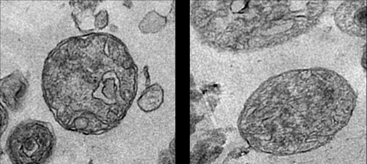 科学家在血液循环中发现意想不到的新成分 – 线粒体