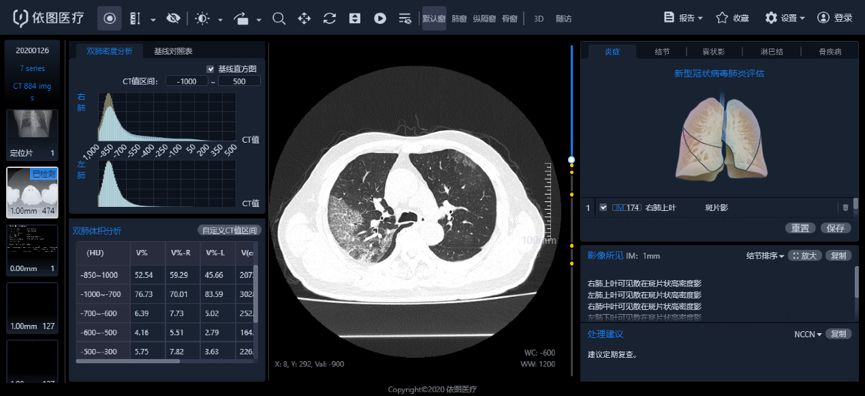 上海上线新冠肺炎智能评价系统，结果与医生相似