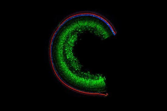 ▲小鼠耳蜗中，绿色的这些细胞转入了修复的 Tmc1 基因（图片来源：参考资料[2]；Credit： Olga Shubina-Oleinik， Boston Children‘s Hospital）