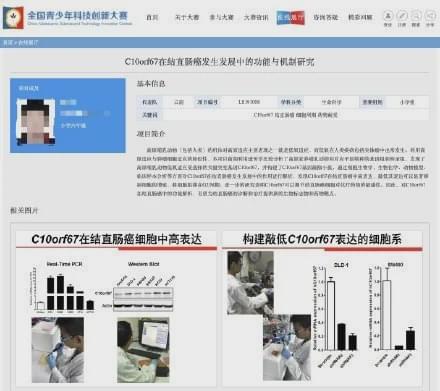 小学生研究结直肠癌获奖 中科院昆明动物所回应