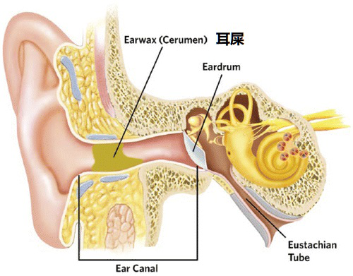 耳朵可不是随便掏的：当心耳屎“得寸进尺”