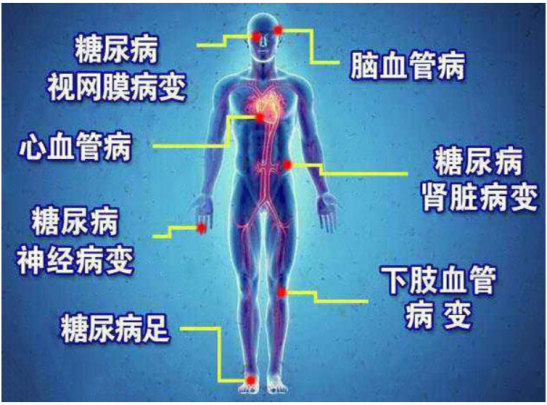 用这种电饭煲就能轻松控制血糖？真相可能要让你失望了 