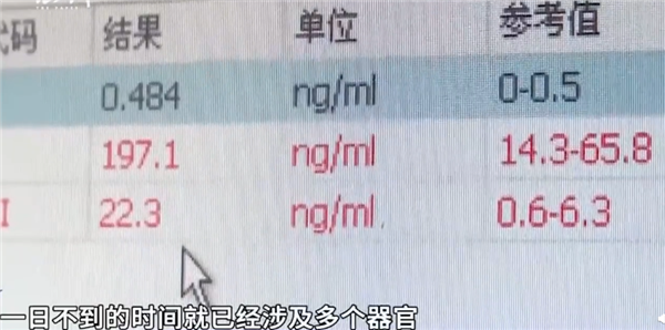 29岁女生被诊断为爆发型糖尿病住ICU：大家都爱喝的饮料是“凶手”