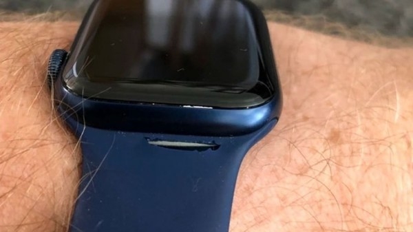 售价379元不到一年就断了：苹果用户吐槽Apple Watch 6单圈表带质量堪忧