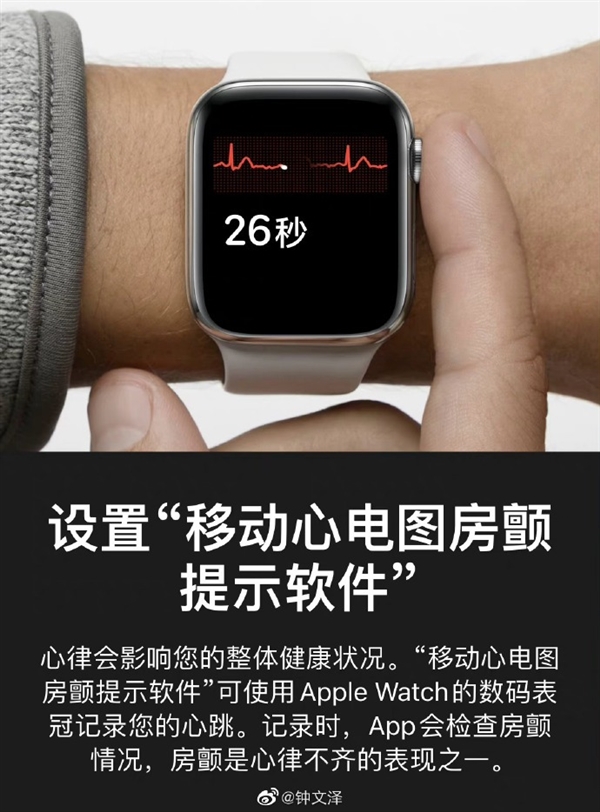 国行Apple Watch终于获得“完全体”！ECG心电图已上线测试版系统