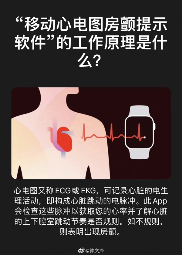 国行Apple Watch终于获得“完全体”！ECG心电图已上线测试版系统