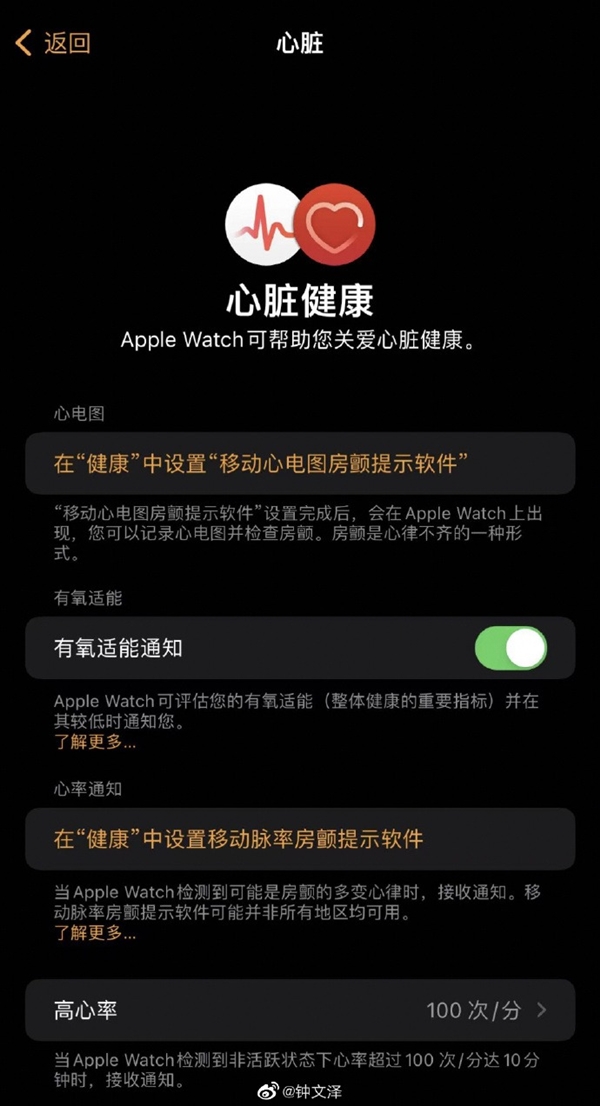 国行Apple Watch终于获得“完全体”！ECG心电图已上线测试版系统