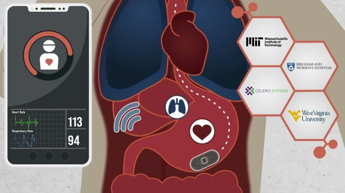 科学家研发可摄入胶囊，用于监测呼吸和心率-冯金伟博客园